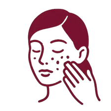 icon_peeling